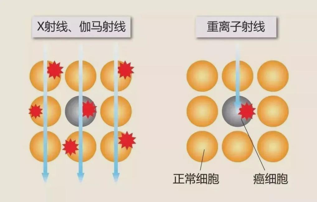 中建三局西安国际医学中心4#质子中心项目质子区筏板混凝土浇筑完成